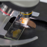 Intruders: Common Types of Intestinal Parasites