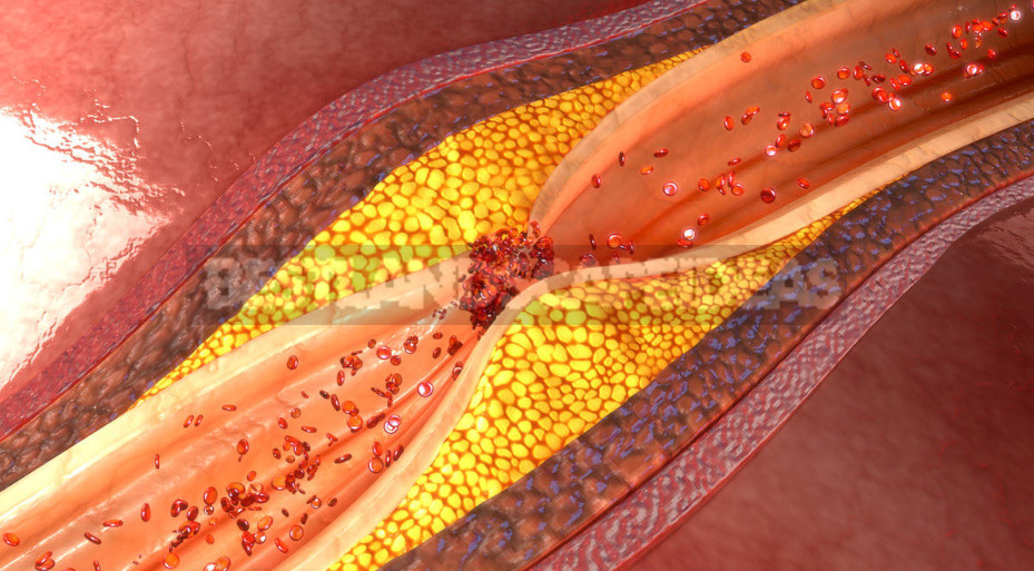 Truth and Myths About Cholesterol