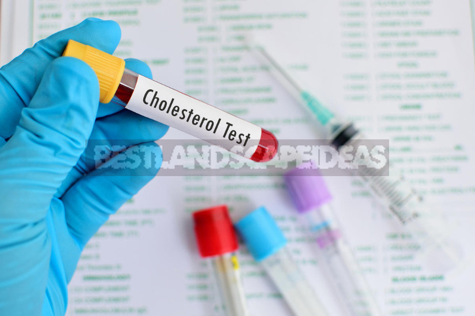 Truth and Myths About Cholesterol